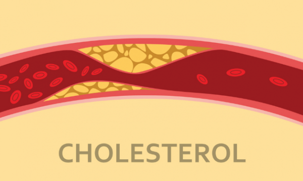 cholesterol là gì